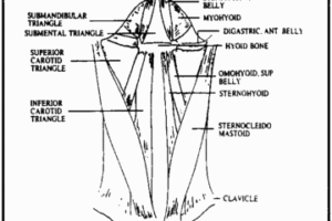 choke2-360x240-300x200 choke2-360x240 