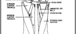 choke2-681x310-300x137 choke2-681x310 