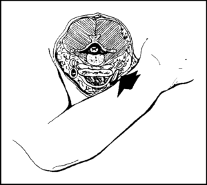 choke3-300x268-300x268 choke3-300x268 